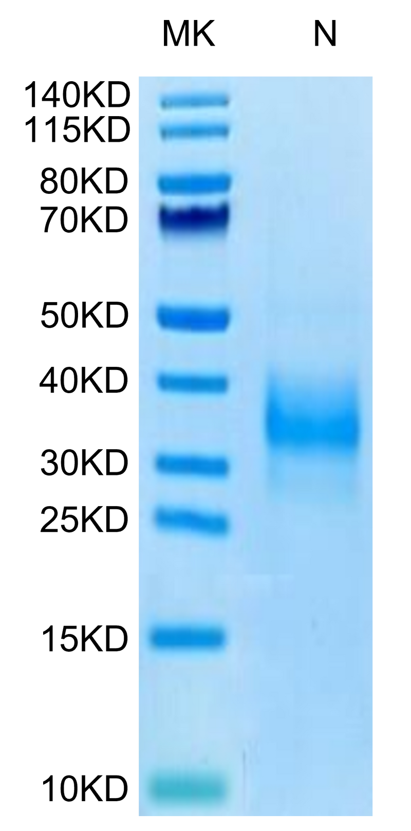 Biotinylated Human SOST on Tris-Bis PAGE under reduced condition. The purity is greater than 95%.