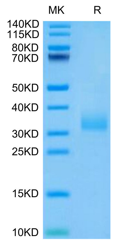 Human Siglec-15 on Tris-Bis PAGE under reduced condition. The purity is greater than 95%.