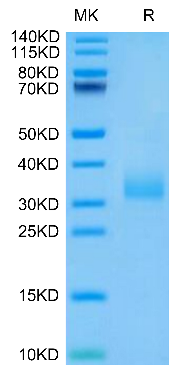 Human Siglec-15 on Tris-Bis PAGE under reduced condition. The purity is greater than 95%.