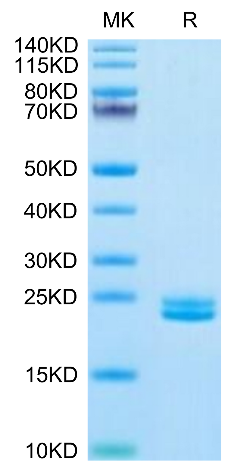 Human IL-11 on Tris-Bis PAGE under reduced condition. The purity is greater than 95%.