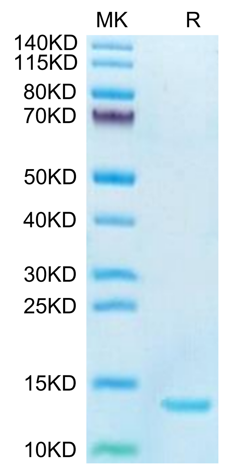 Human DDT on Tris-Bis PAGE under reduced condition. The purity is greater than 95%.