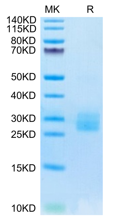 Biotinylated Human IL-25 on Tris-Bis PAGE under reduced condition. The purity is greater than 95%.