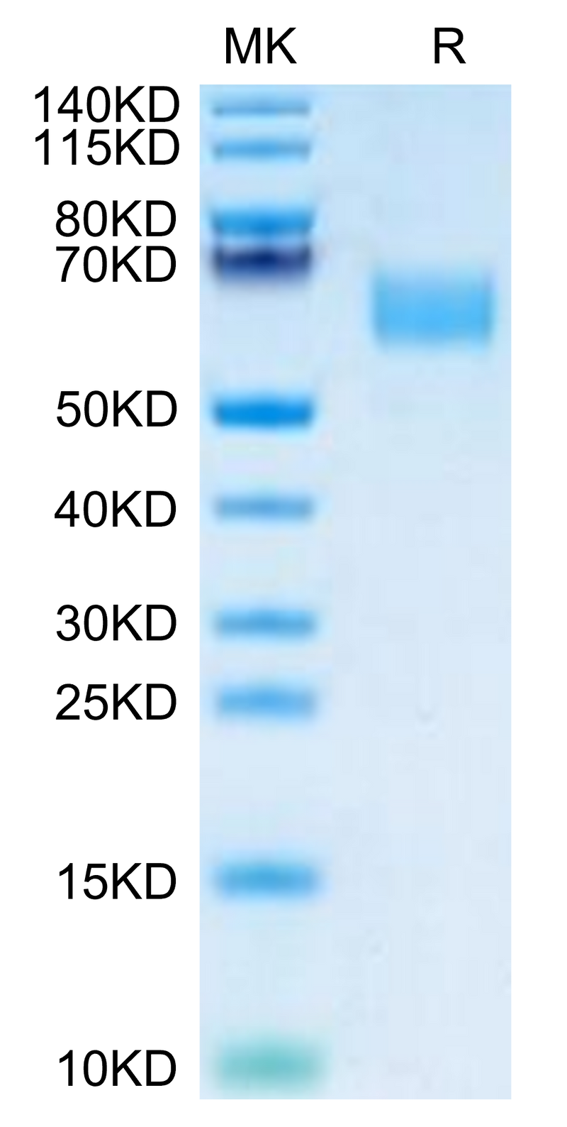 Mouse CD47 on Tris-Bis PAGE under reduced condition. The purity is greater than 95%.