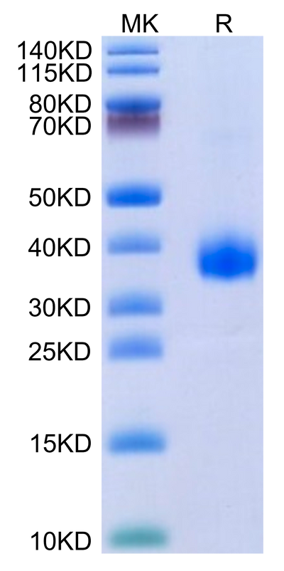 SARS-Cov-2 Spike RBD (B.1.640.2/IHU) on Tris-Bis PAGE under reduced condition. The purity is greater than 95%.