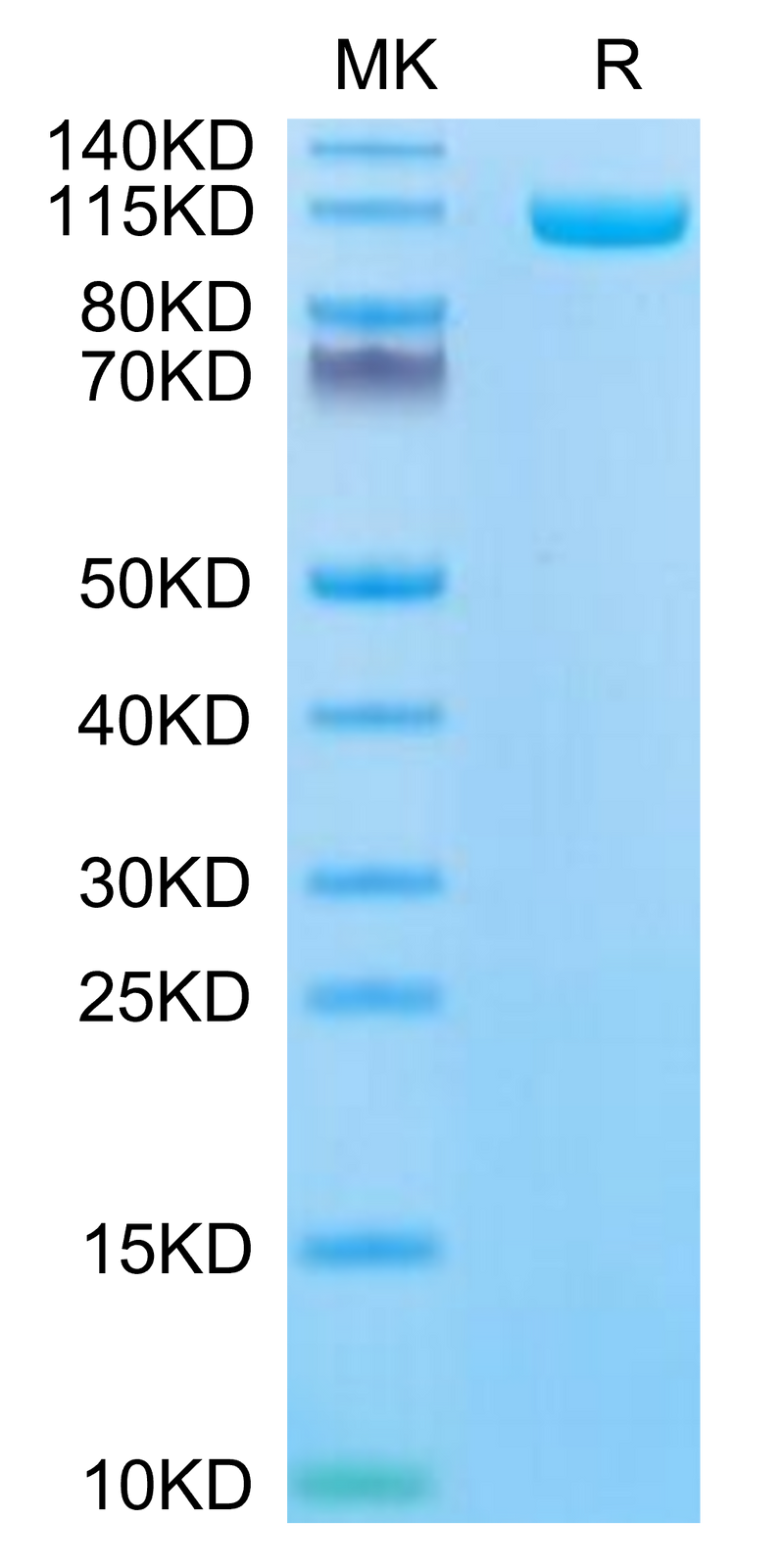 Biotinylated Human ENPP-1 on Tris-Bis PAGE under reduced condition. The purity is greater than 95%.