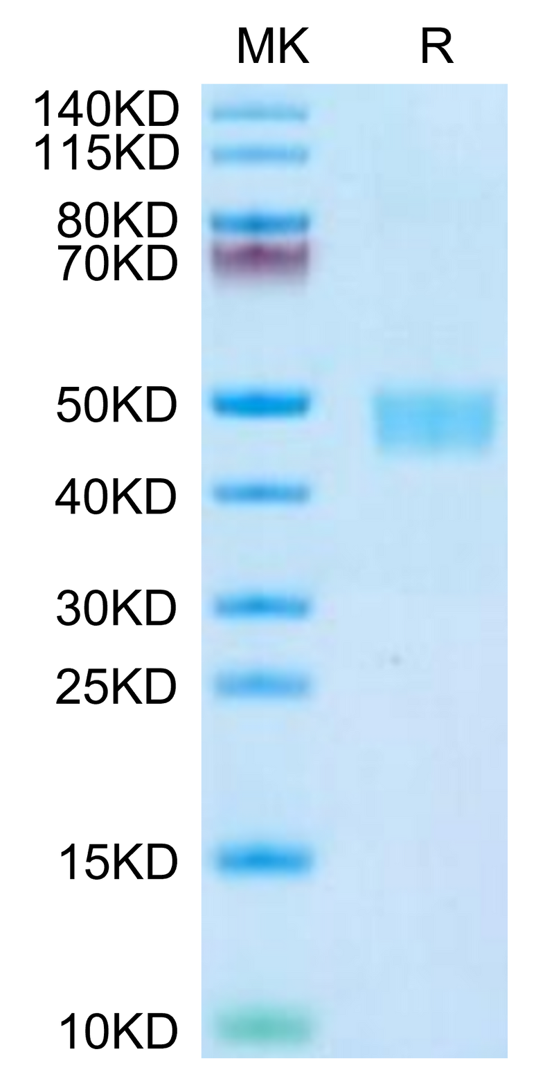 Mouse CD59a on Tris-Bis PAGE under reduced condition. The purity is greater than 95%.