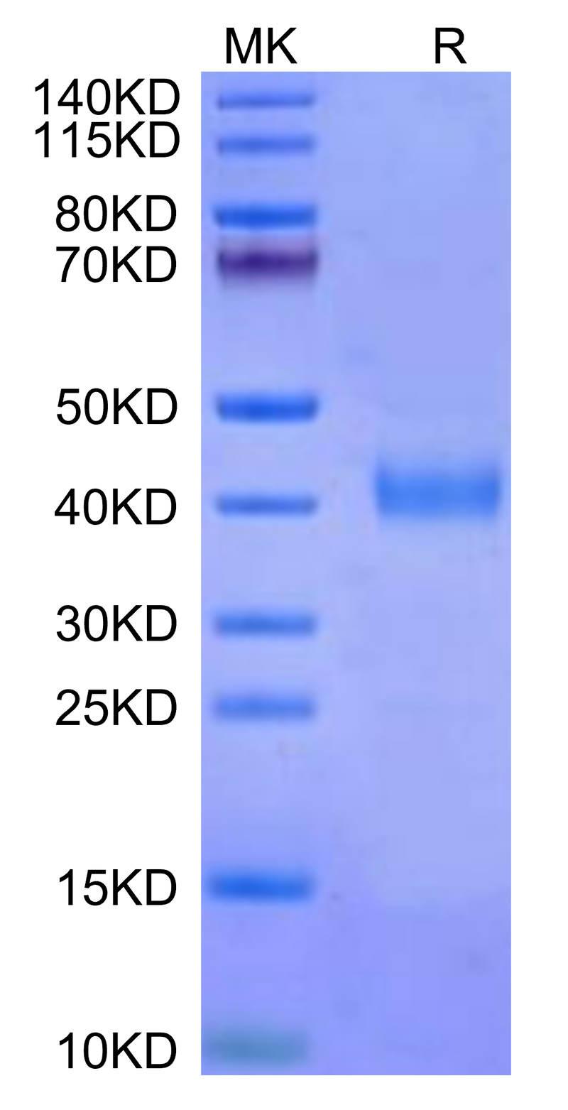 Cynomolgus IL-2 R beta on Tris-Bis PAGE under reduced conditions. The purity is greater than 95%.