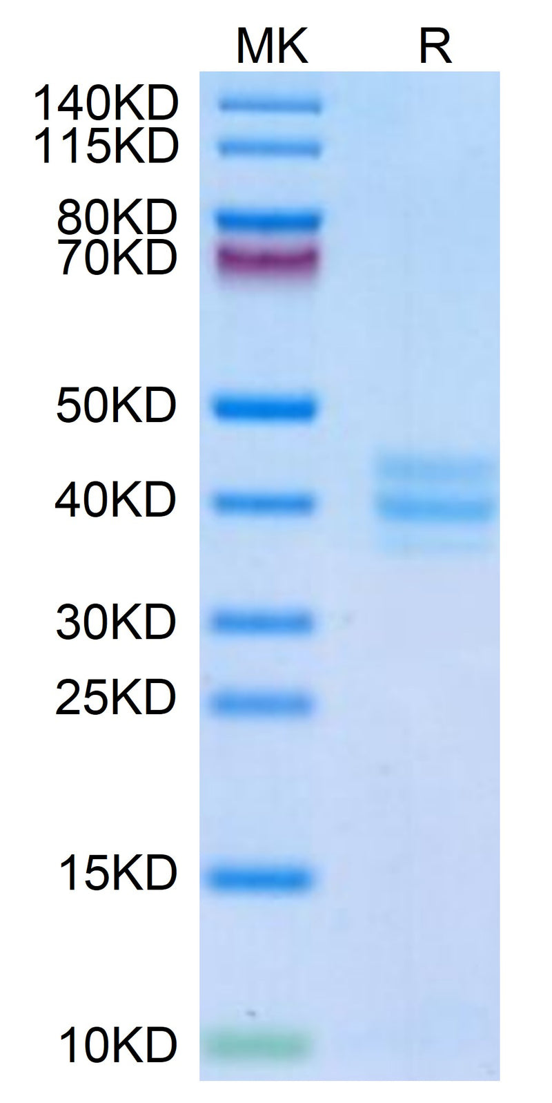 Mouse GPA33 on Tris-Bis PAGE under reduced condition. The purity is greater than 95%.