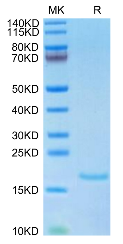 Human IL-10 on Tris-Bis PAGE under reduced condition. The purity is greater than 95%.