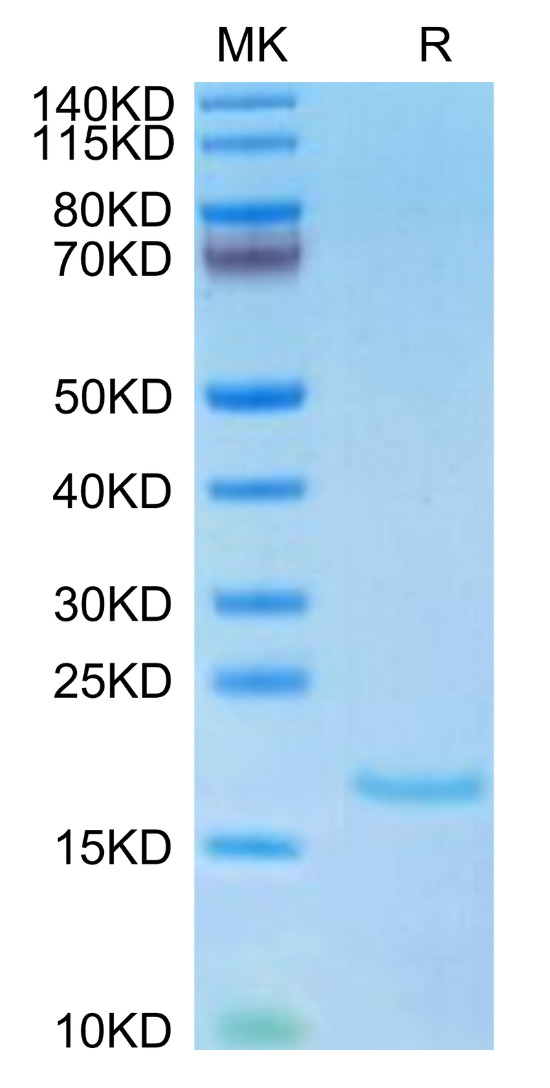 Human IL-10 on Tris-Bis PAGE under reduced condition. The purity is greater than 95%.