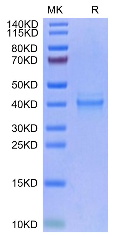 Human IL-12 on Tris-Bis PAGE under reduced condition. The purity is greater than 95%.