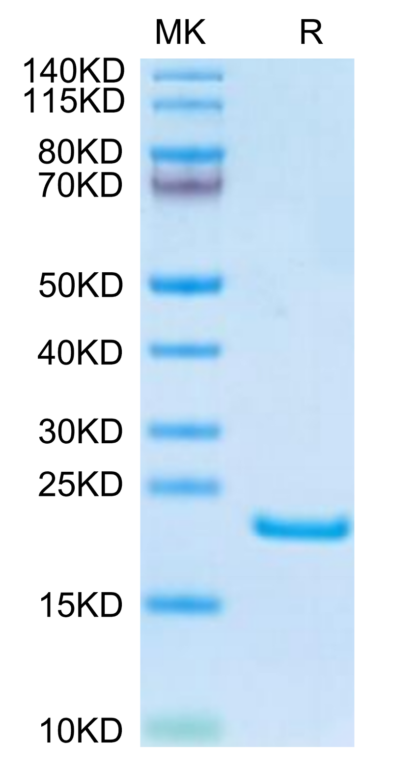 Human AGR-2 on Tris-Bis PAGE under reduced condition. The purity is greater than 95%.