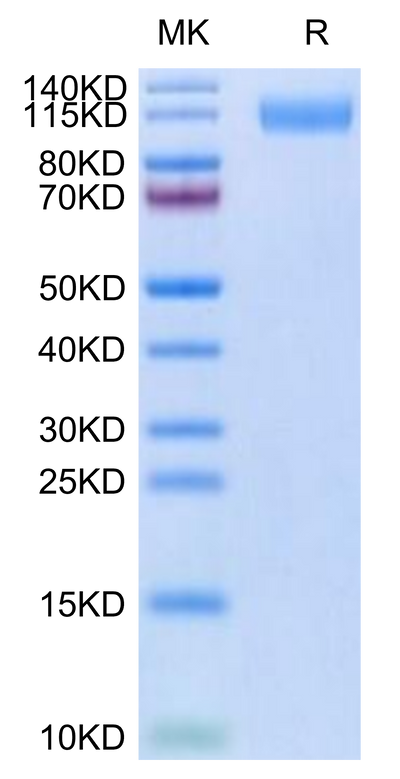 SARS-COV-2 Spike S1 (B.1.640.2/IHU) on Tris-Bis PAGE under reduced condition. The purity is greater than 95%.