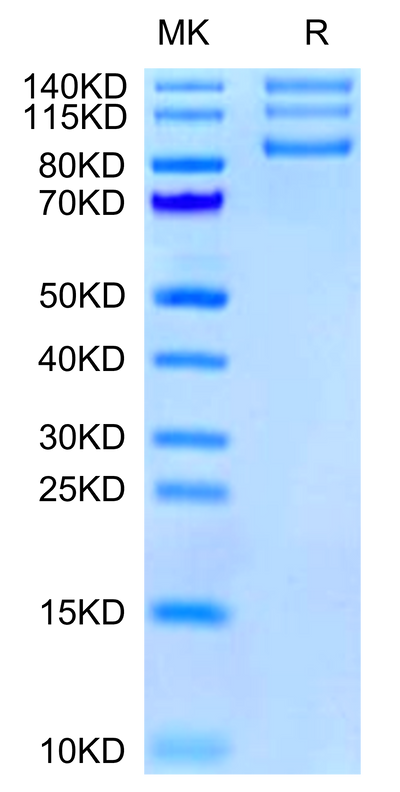 Human ITGAV&ITGB8 on Tris-Bis PAGE under reduced condition. The purity is greater than 95%.