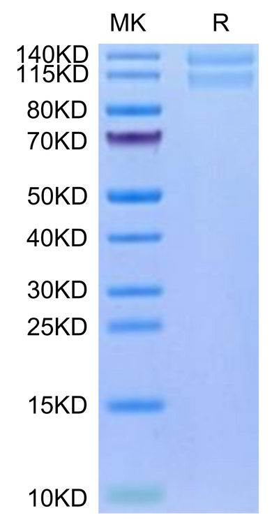 Human ITGA2&ITGB1 on Tris-Bis PAGE under reduced condition. The purity is greater than 95%.