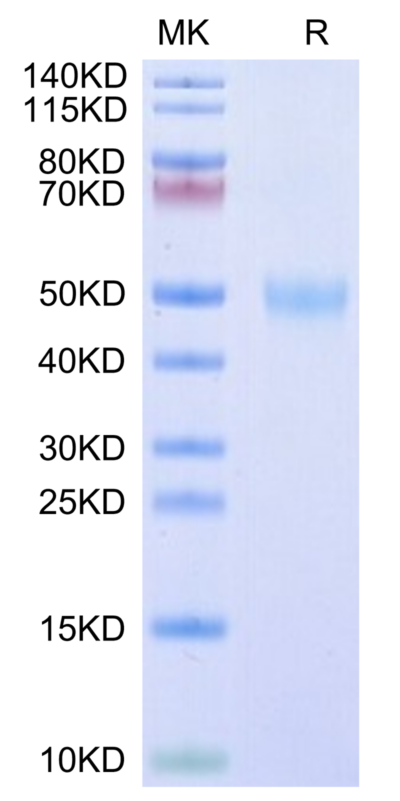 Human/Cynomolgus/Rhesus macaque ROR1 (30-305,Ig-like&Frizzled Domain) on Tris-Bis PAGE under reduced condition. The purity is greater than 95%.