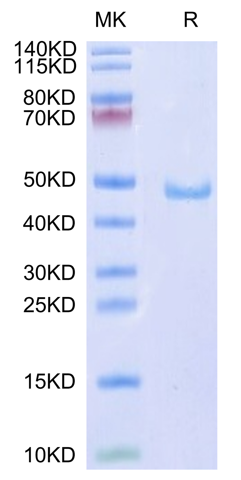 Human CD59 on Tris-Bis PAGE under reduced condition. The purity is greater than 95%.