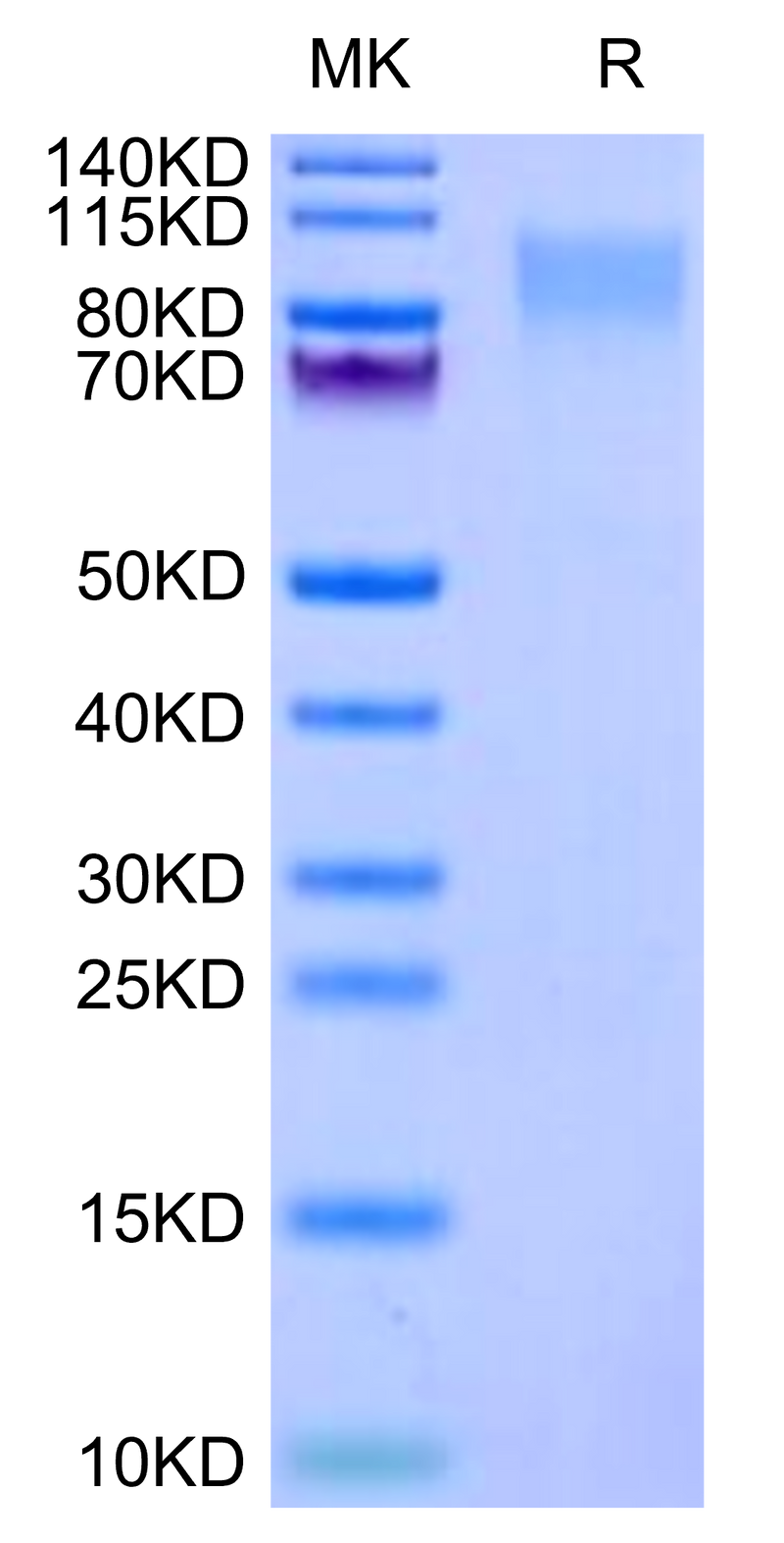 Human ICAM-3 on Tris-Bis PAGE under reduced condition. The purity is greater than 95%.