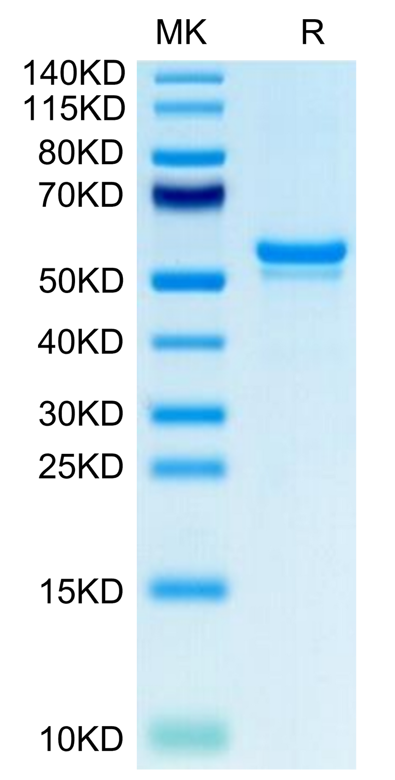 Human CA9 on Tris-Bis PAGE under reduced condition. The purity is greater than 95%.