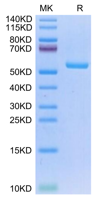 Human HLA-A*02:01&B2M&NY-ESO-1 (SLLMWITQV) Monomer on Tris-Bis PAGE under reduced condition. The purity is greater than 95%.