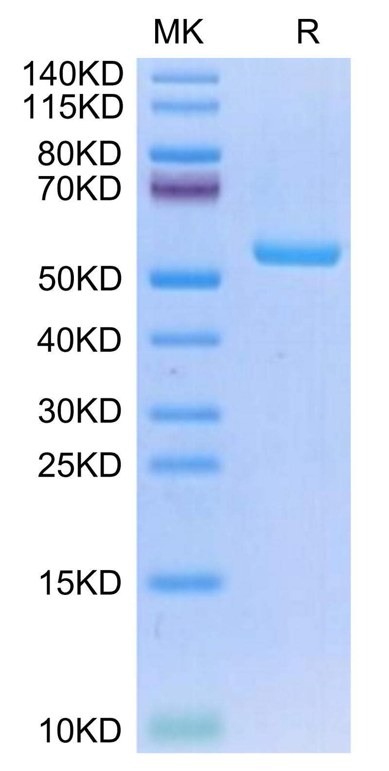 Recombinant Human HLA-A*02:01&B2M&NY-ESO-1 (SLLMWITQV) Monomer Protein ...