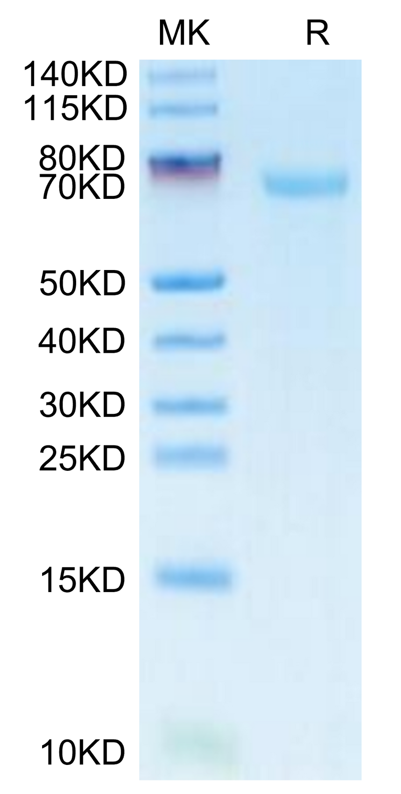 FITC-Labeled Human B7-H3 on Tris-Bis PAGE under reduced condition. The purity is greater than 95%.