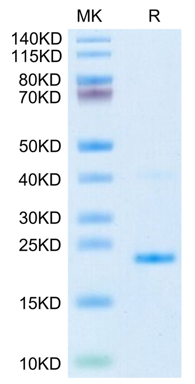 Mouse IL-17B on Tris-Bis PAGE under reduced condition. The purity is greater than 95%.