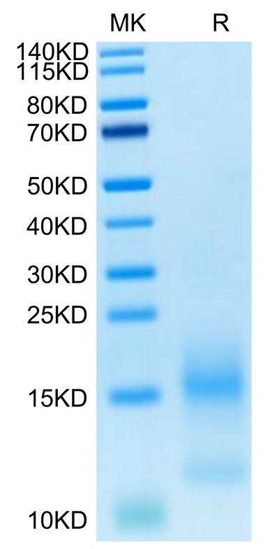 FITC-Labeled Human BCMA on Tris-Bis PAGE under reduced condition. The purity is greater than 95%.