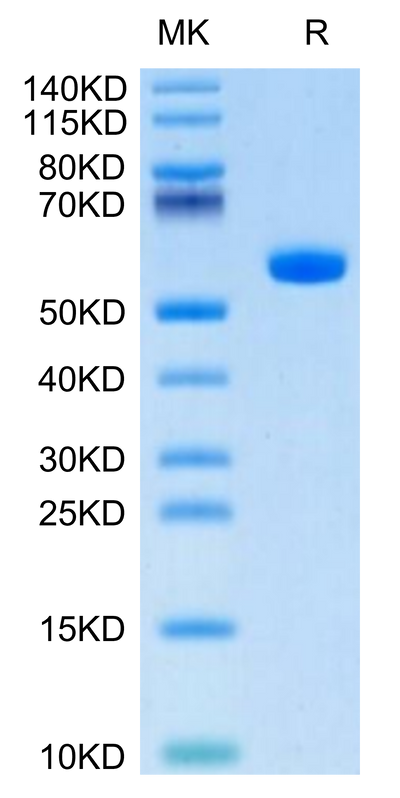 Human HLA-A*01:01&B2M&CT83 (NTDNNLAVY) Monomer on Tris-Bis PAGE under reduced condition. The purity is greater than 95%.