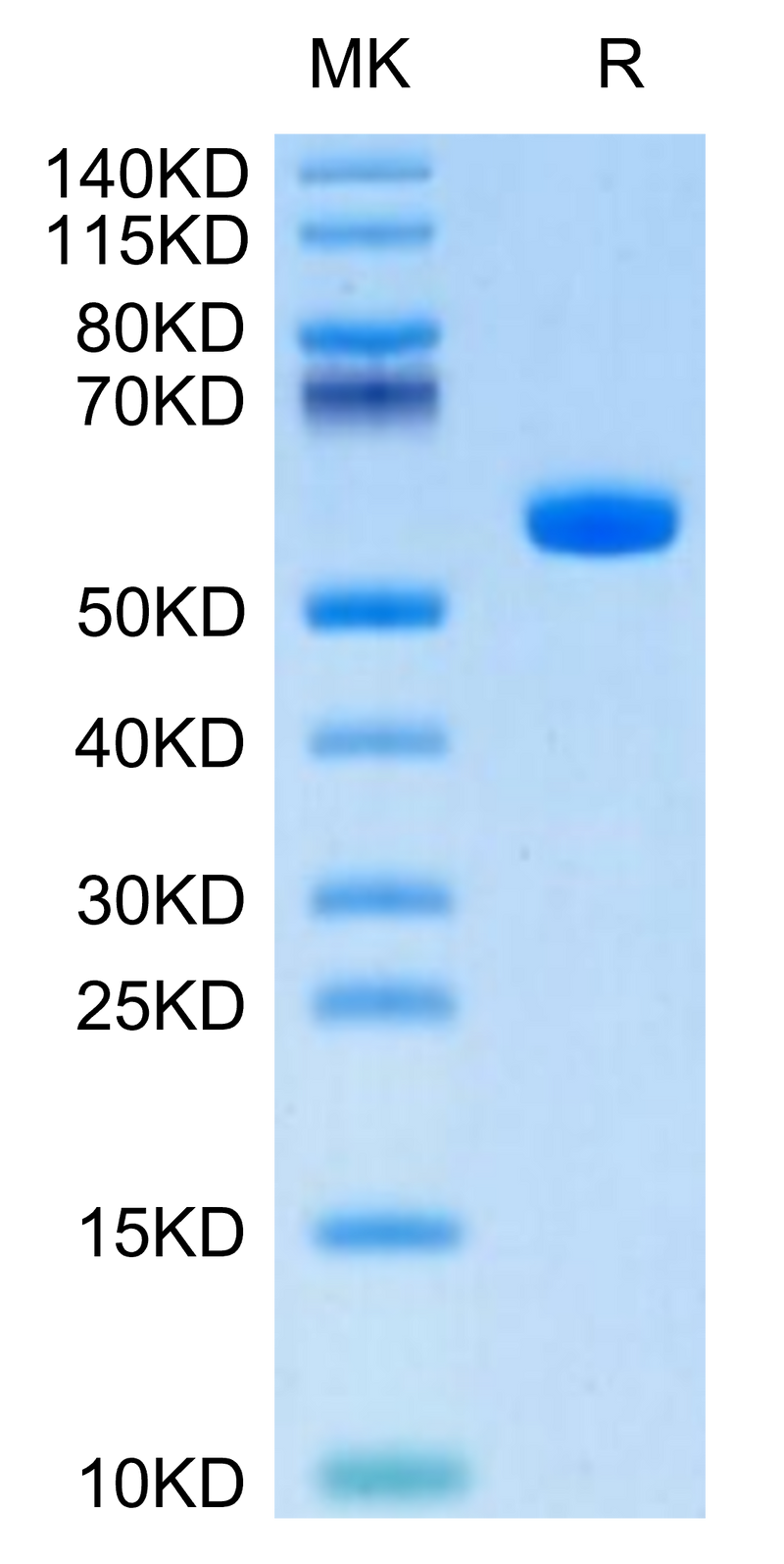 Human HLA-A*01:01&B2M&CT83 (NTDNNLAVY) Monomer on Tris-Bis PAGE under reduced condition. The purity is greater than 95%.