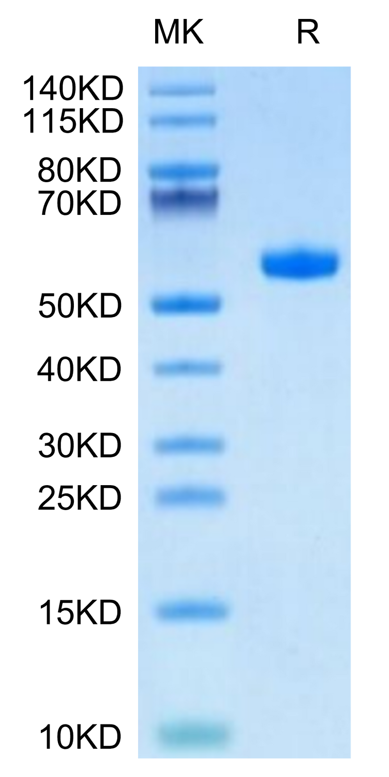 Human HLA-A*01:01&B2M&MAGE-A3 (EVDPIGHLY) Monomer on Tris-Bis PAGE under reduced condition. The purity is greater than 95%.