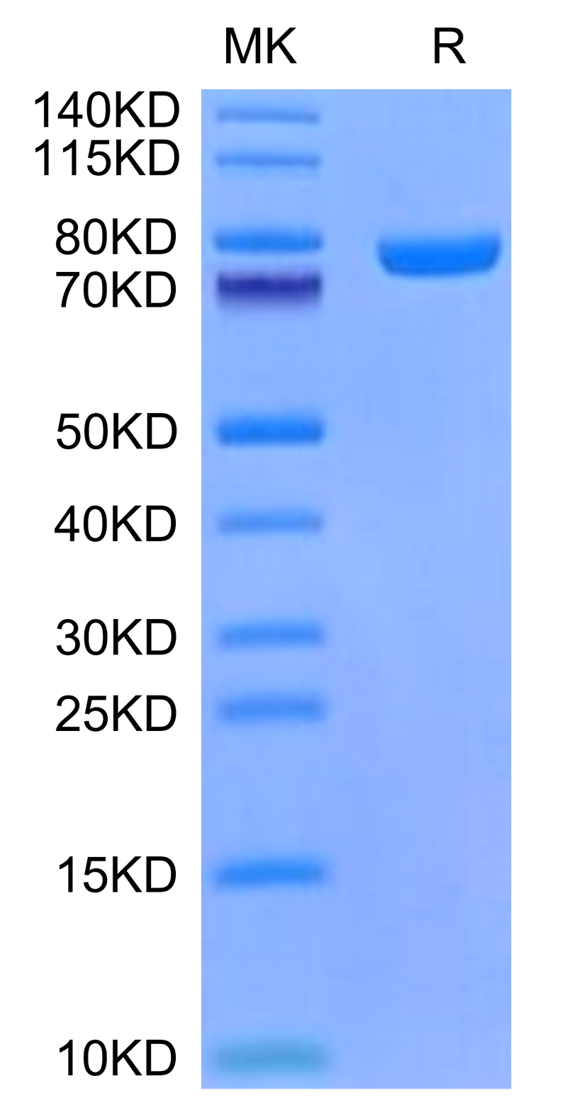 Mouse CD228 on Tris-Bis PAGE under reduced condition. The purity is greater than 95%.