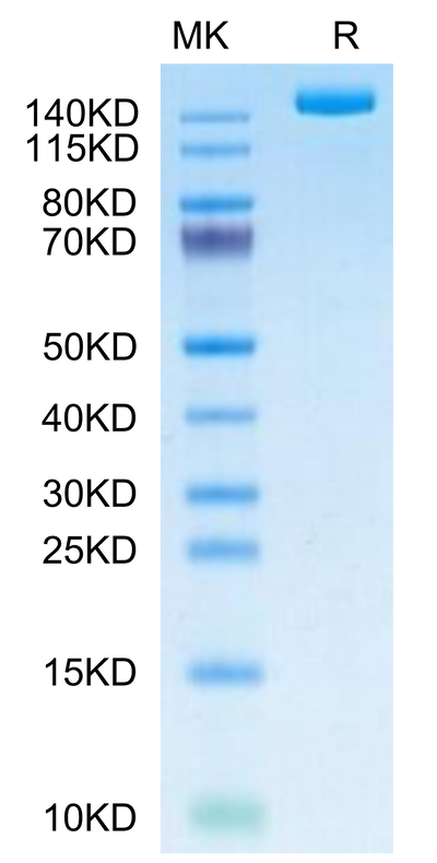 SARS-COV-2 Spike S (B.1.640.2/IHU) Trimer on Tris-Bis PAGE under reduced condition. The purity is greater than 95%.