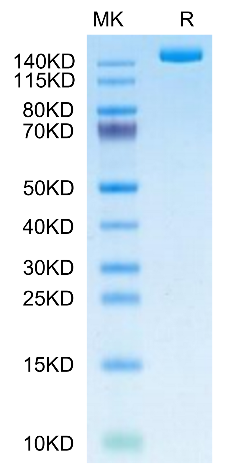 SARS-COV-2 Spike S (B.1.640.2/IHU) Trimer on Tris-Bis PAGE under reduced condition. The purity is greater than 95%.