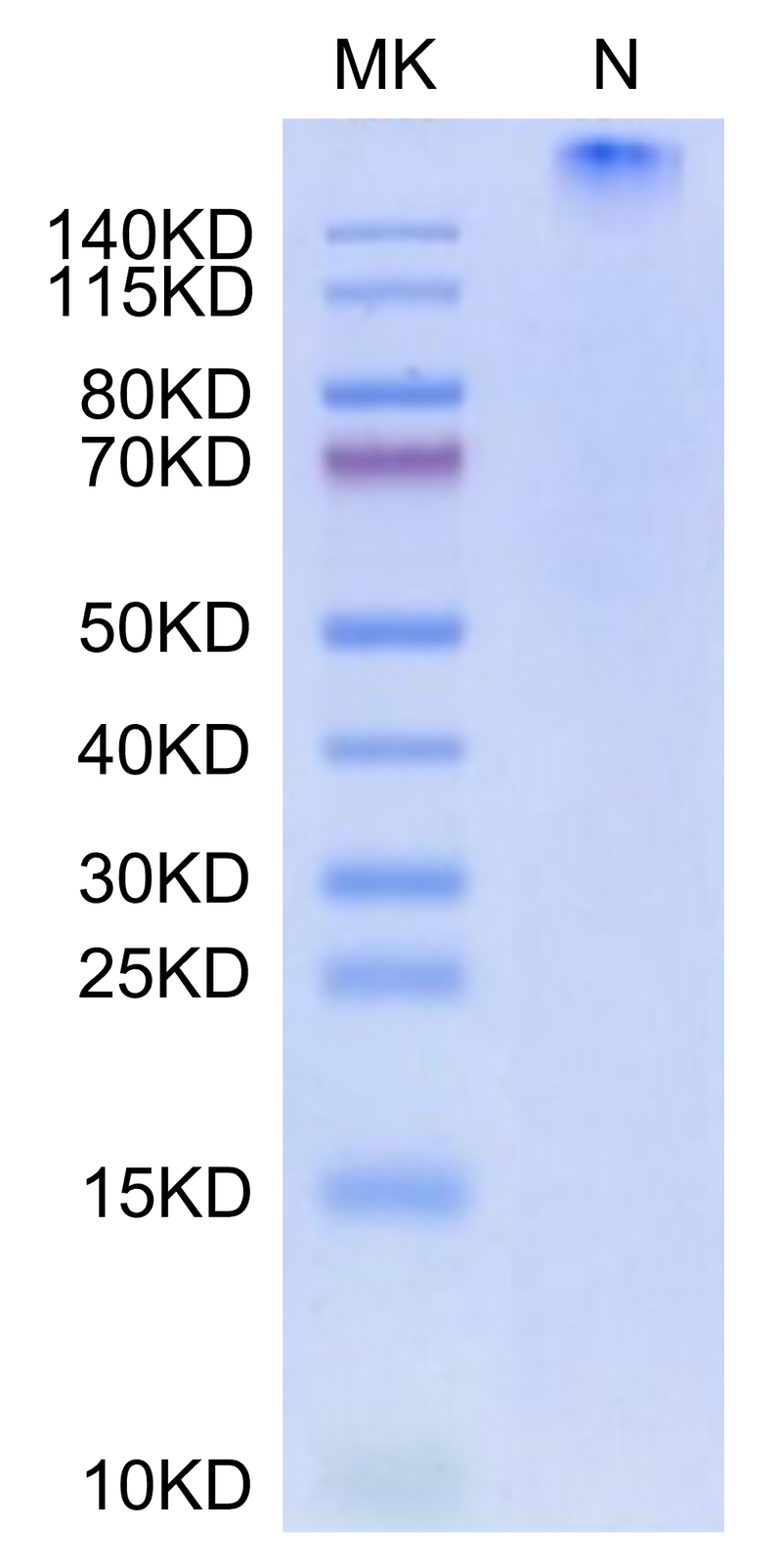 Human HLA-A*01:01&B2M&CT83 (NTDNNLAVY) Tetramer on Tris-Bis PAGE under Non reducing (N) condition. The purity is greater than 95%.