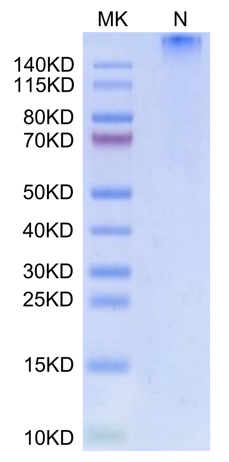 Human HLA-A*01:01&B2M&MAGE-A3 (EVDPIGHLY) Tetramer on Tris-Bis PAGE under Non reducing (N) condition. The purity is greater than 95%.