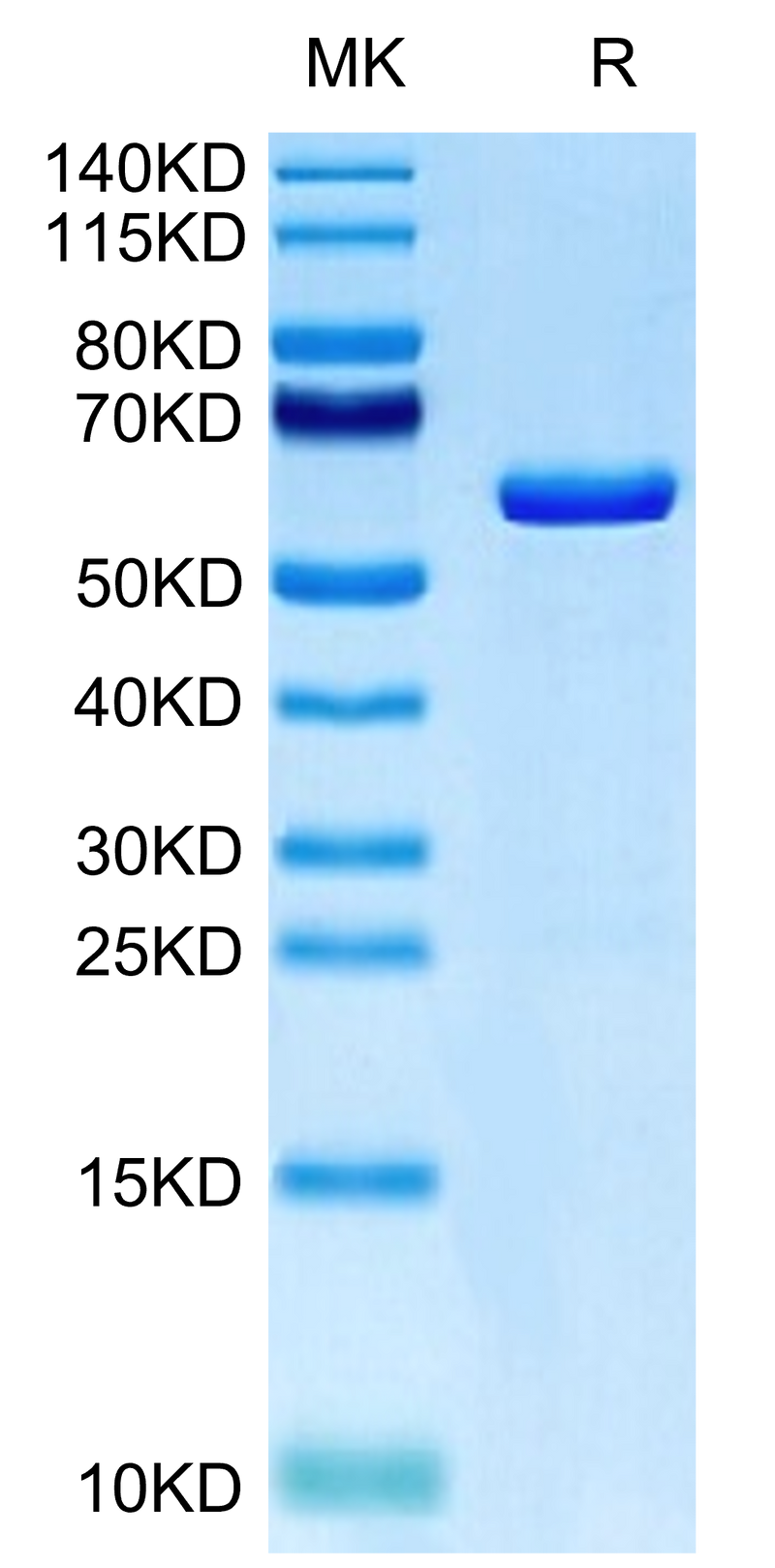 Human TRAIL Trimer on Tris-Bis PAGE under reduced condition. The purity is greater than 95%.