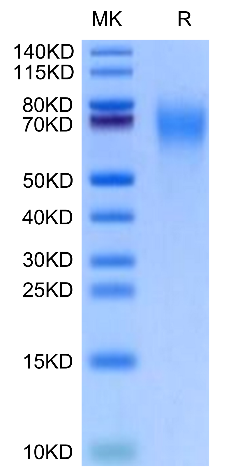 Cynomolgus CD200 R1 on Tris-Bis PAGE under reduced condition. The purity is greater than 95%.