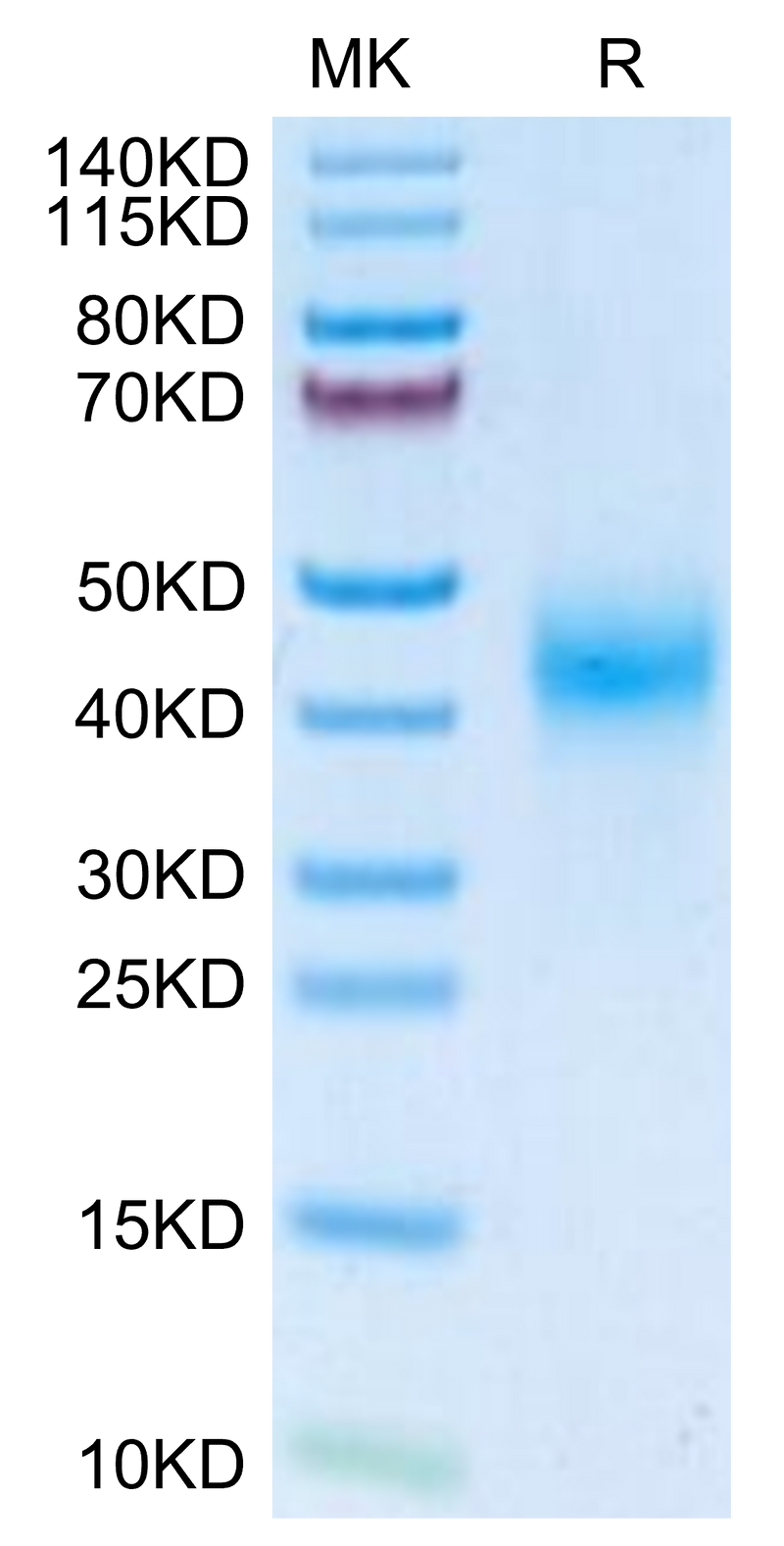 Mouse Fc gamma RIII on Tris-Bis PAGE under reduced condition. The purity is greater than 95%.