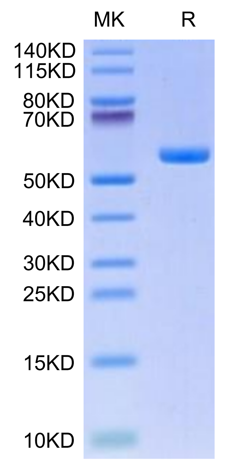 Human HLA-A*11:01&B2M&KRAS G12V (VVGAVGVGK) Monomer on Tris-Bis PAGE under reduced condition. The purity is greater than 95%.