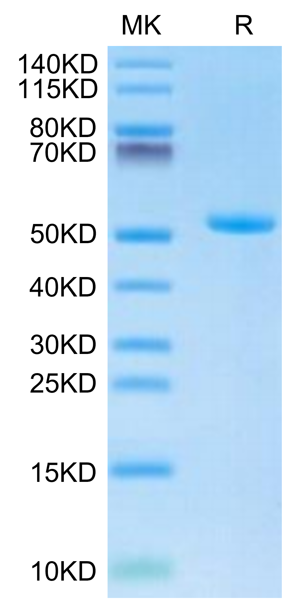 Recombinant Human TLT-1/TREML1 Protein - High Quality | Beta LifeScience