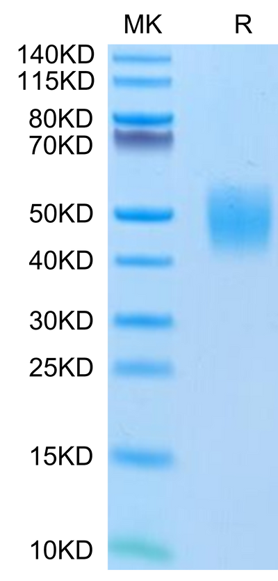 Human FGFR2 beta (IIIc) on Tris-Bis PAGE under reduced conditions. The purity is greater than 95%.