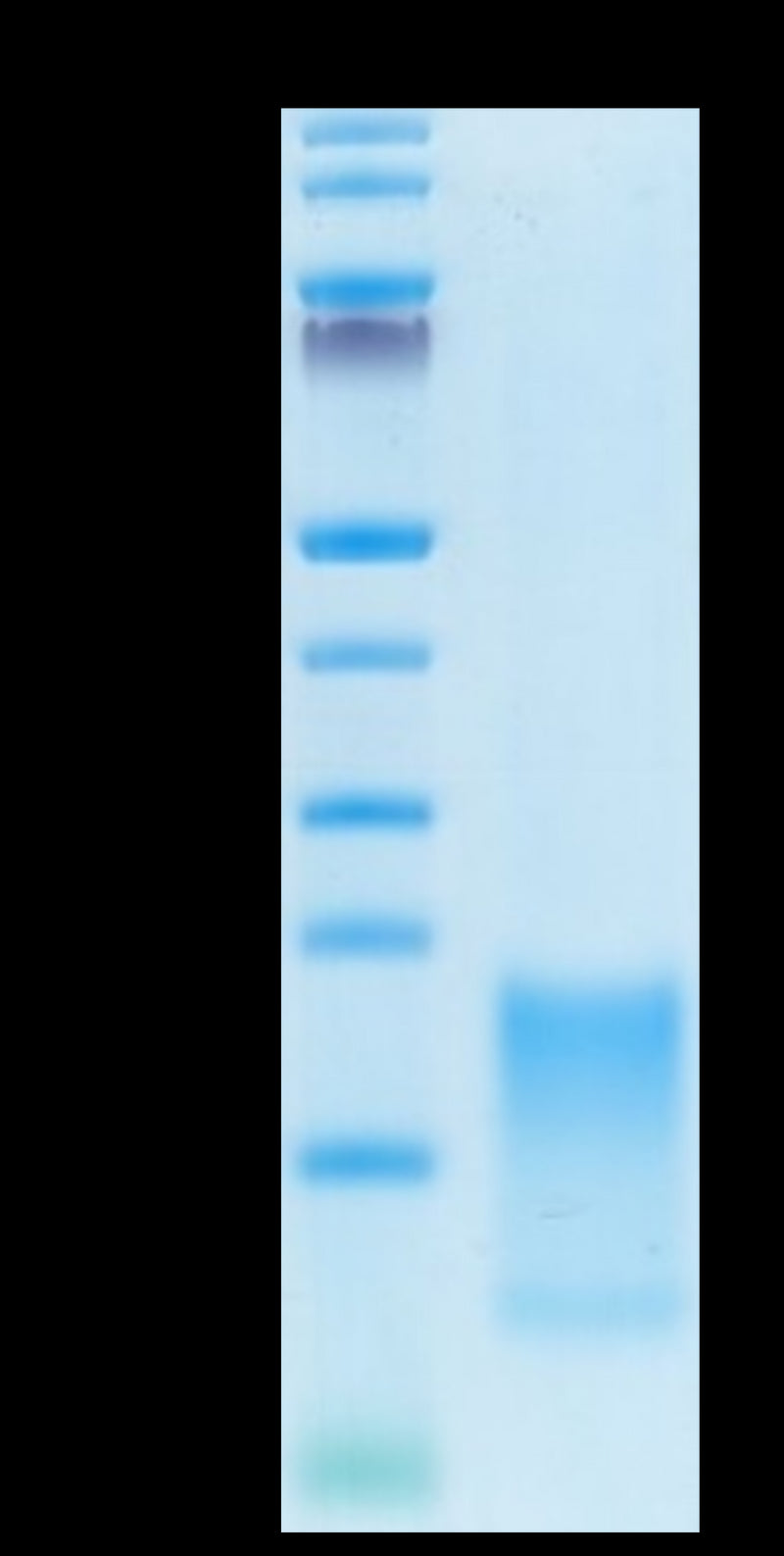 Cynomolgus BAFFR on Tris-Bis PAGE under reduced condition. The purity is greater than 95%.