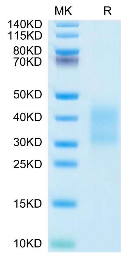 Mouse CD79B on Tris-Bis PAGE under reduced condition. The purity is greater than 95%.