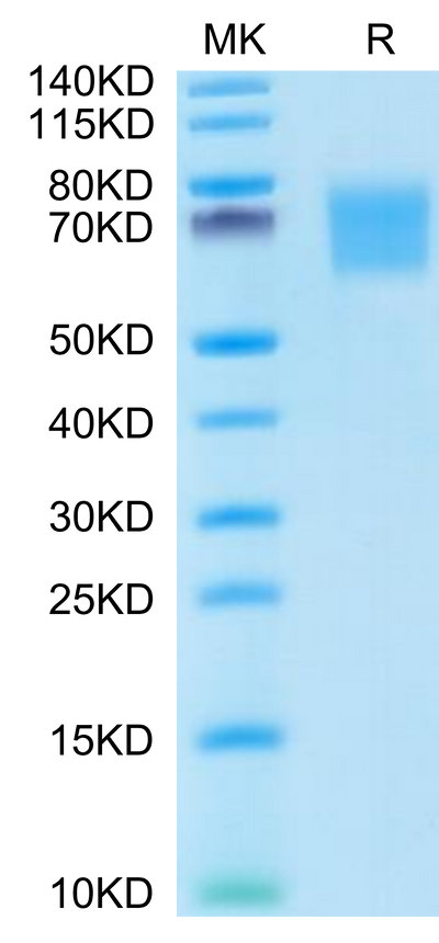 Human FGFR2 alpha (IIIb) on Tris-Bis PAGE under reduced conditions. The purity is greater than 95%.