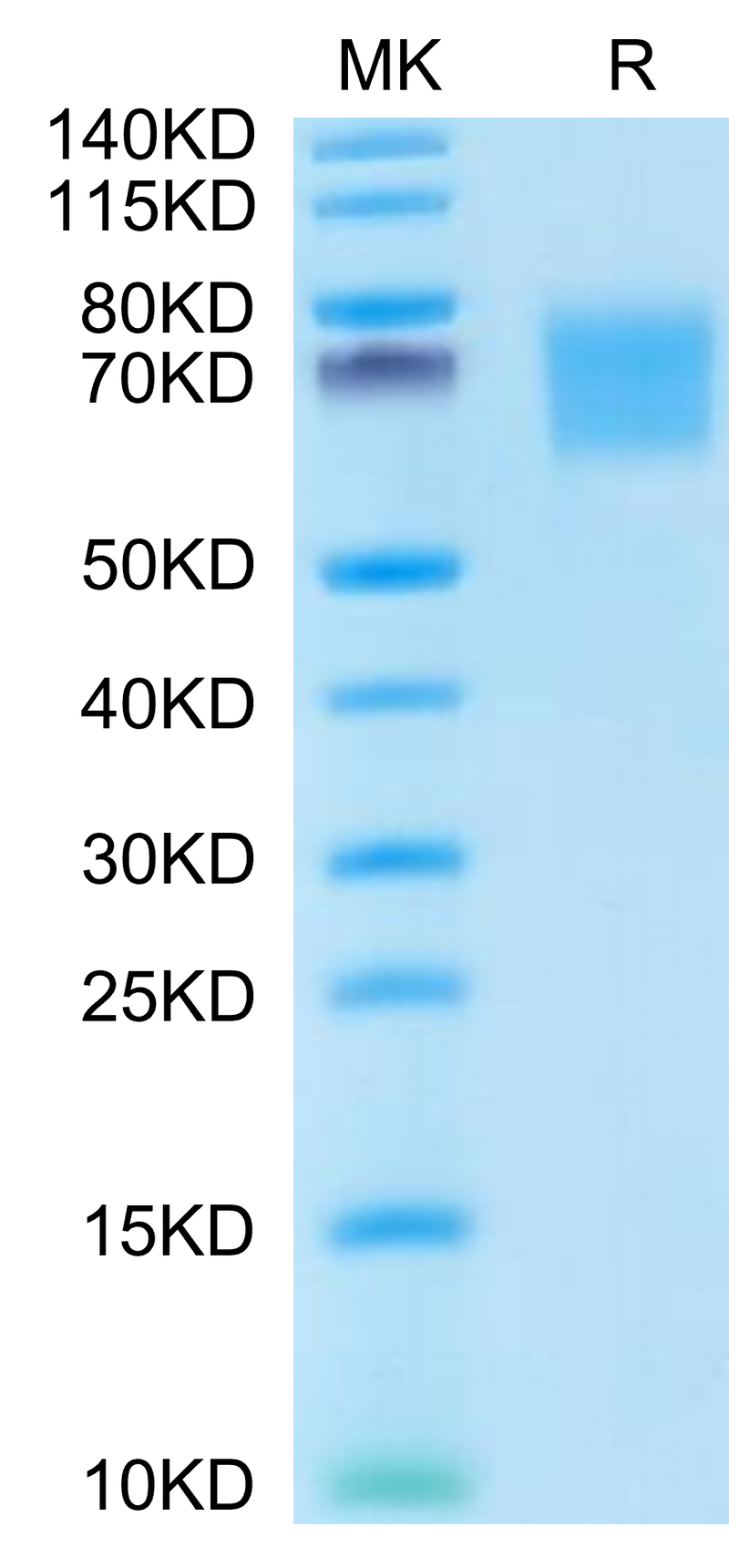 Human FGFR2 alpha (IIIb) on Tris-Bis PAGE under reduced conditions. The purity is greater than 95%.