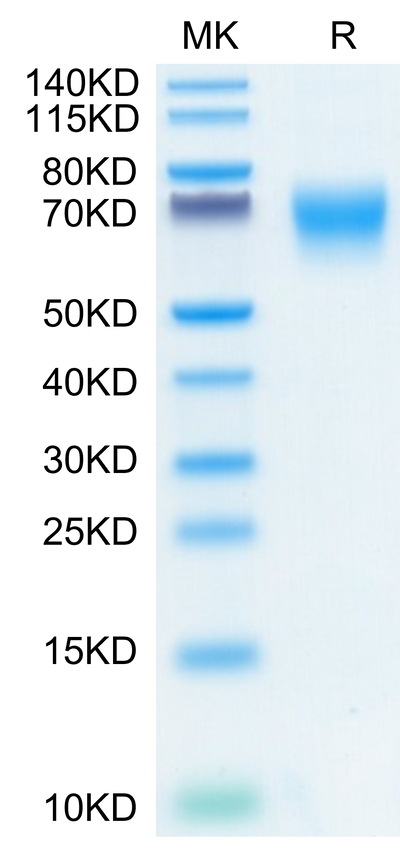 Human FGFR2 alpha (IIIc) on Tris-Bis PAGE under reduced conditions. The purity is greater than 95%.