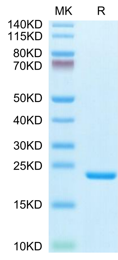 Biotinylated Human IL-1 Beta on Tris-Bis PAGE under reduced condition. The purity is greater than 95%.