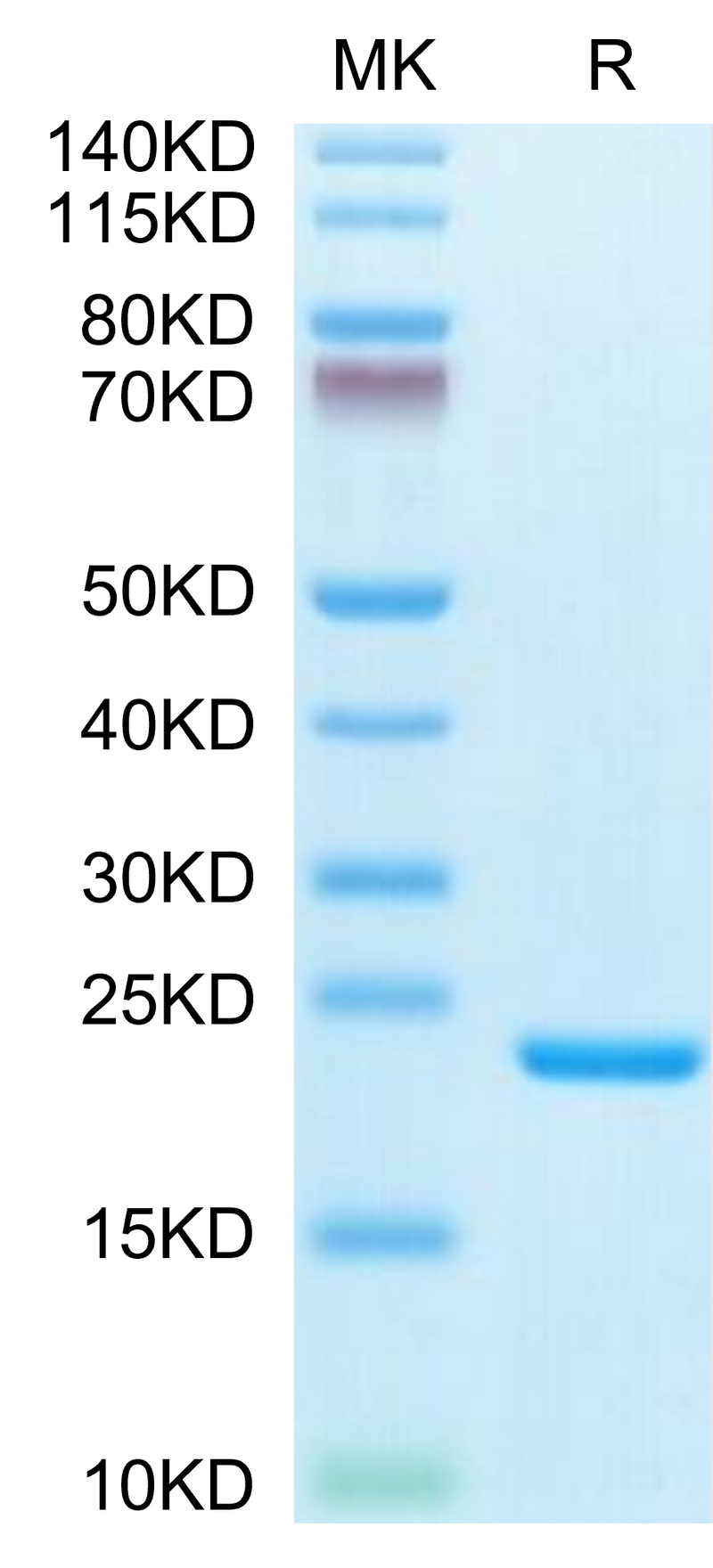 Biotinylated Human IL-1 Beta on Tris-Bis PAGE under reduced condition. The purity is greater than 95%.