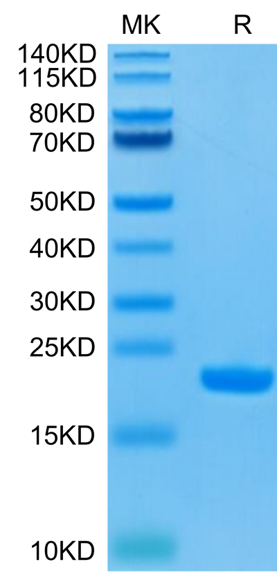 Human IL-1 Beta on Tris-Bis PAGE under reduced condition. The purity is greater than 95%.